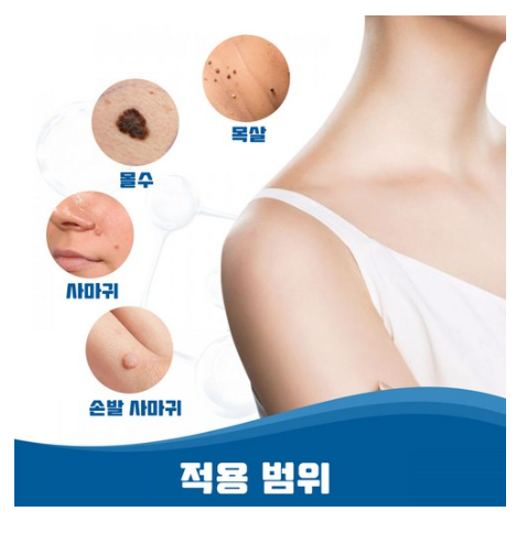 피부 제거 패치 얼굴 바디 피부 치료 라벨 스텔스 포장증정, 145매입, 2개